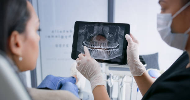 Licensed Dental Implants service in Bridgeport, MI - Smile Center Dentistry