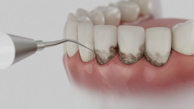 Reliable Dental Implants contractor in Bridgeport, MI by Smile Center Dentistry
